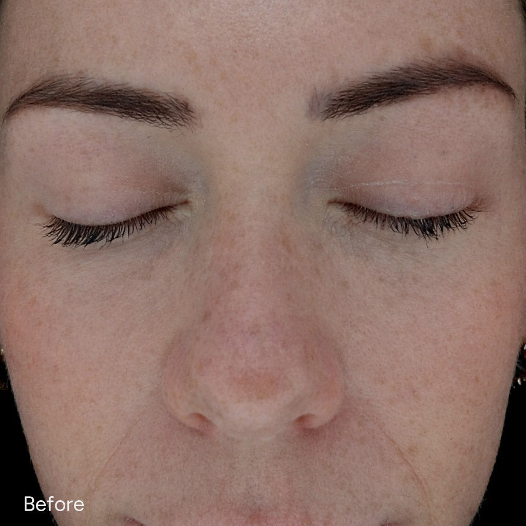 Close-up of a person's face with 'Before' label